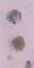 ANDROSTADIENDIONE